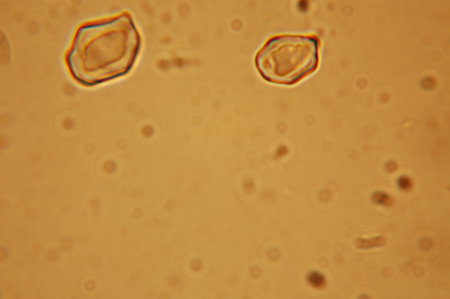 Messa a punto del microscopio